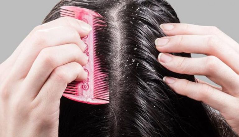 نصائح للتخلص من قشرة الشعر