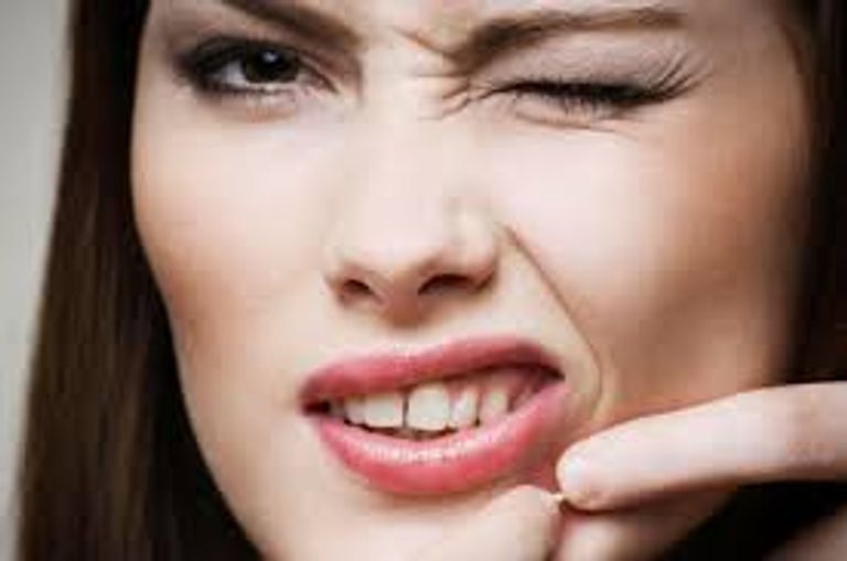 انتشار حب الشباب مرتبط بمشاكل صحية