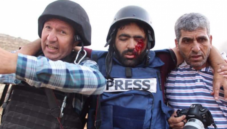 المصور الصحفي الفلسطيني معاذ عمارنة فقد عينه اليسرى برصاص الاحتلال