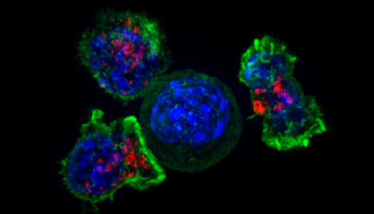الخلايا التائية المناعية تحيط بالخلية السرطانية 
