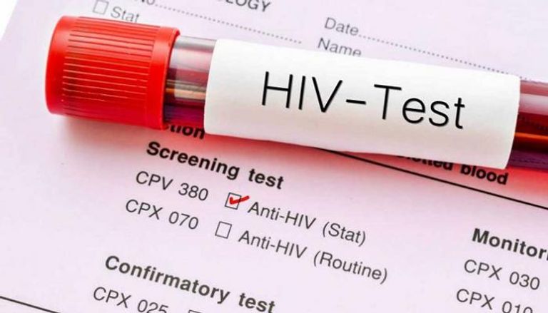 اختبار فيروس "الإيدز" - أرشيفية