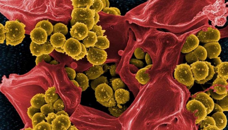 بكتيريا المكورات العنقودية بارعة في مقاومة المضادات الحيوية