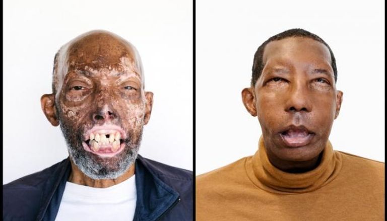 أبرز 5 عمليات جراحية ناجحة في عام 2019