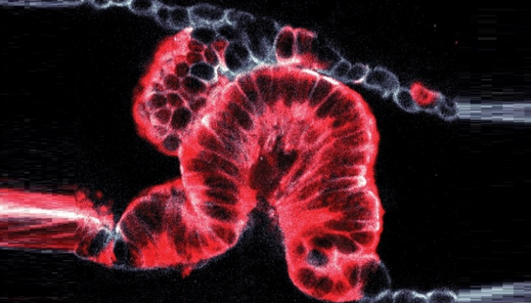 تصوير ثلاثي الأبعاد لسرطان البنكرياس