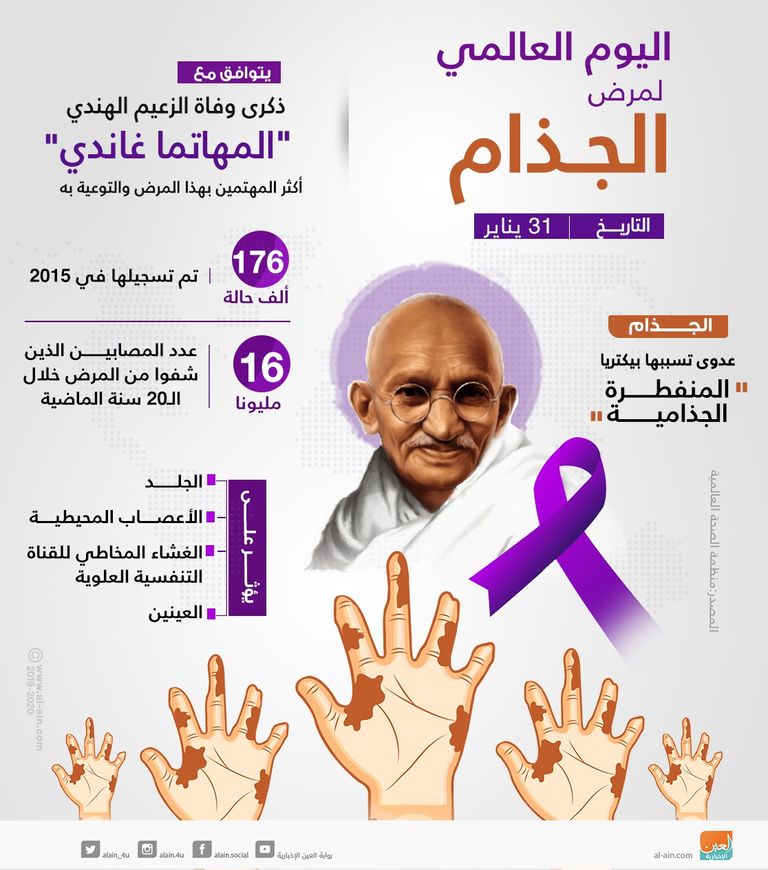 مرض الجذام - أرشيفية