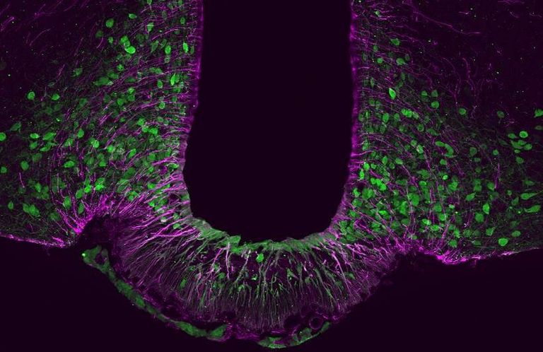 جين Tbx3 (اللون الأخضر) يلعب دورا حاسما في التفاعل بين الخلايا