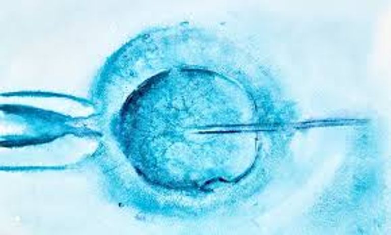 الحمل بالتلقيح الصناعي قد يهدد السيدات بمضاعفات حادة - أرشيفية