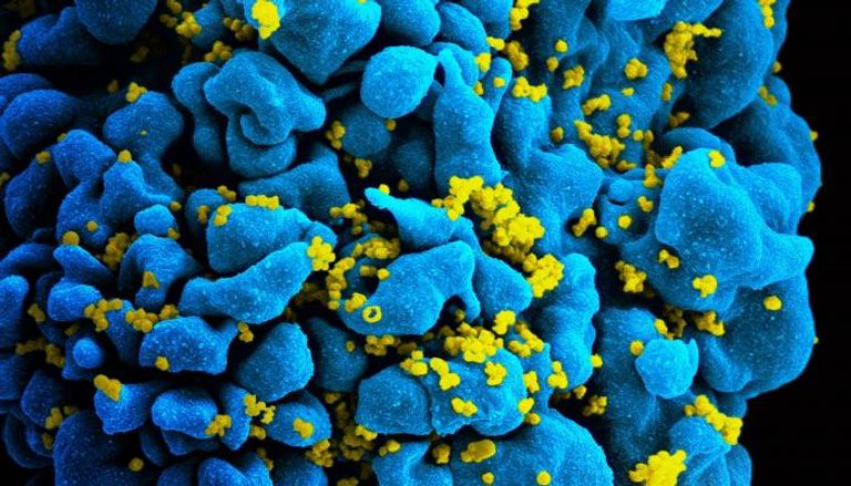 مسح كهرومغناطيسي لخلية تائية مصابة بفيروس نقص المناعة الإيدز - أرشيفية