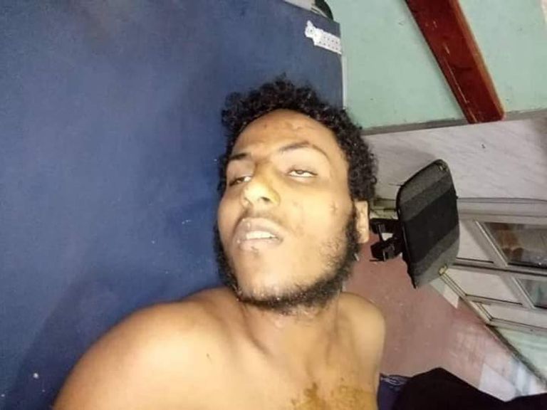 الإرهابي الداعشي عامر العربي أحد المطلوبين للجيش اليمني - أرشيفية