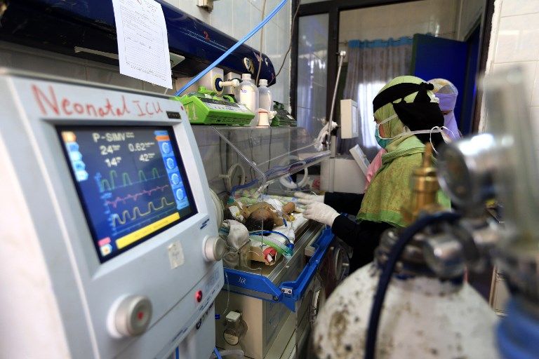 التوأمان السياميان اليمنيان في حاضنة بمستشفى قرب العاصمة اليمنية