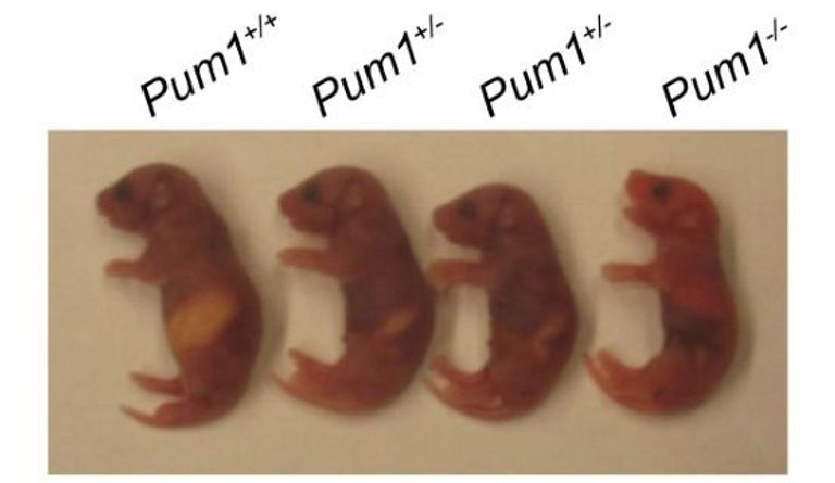 علماء صينيون يكتشفون آلية تمهد لعلاج الأورام البشرية - صورة أرشيفية
