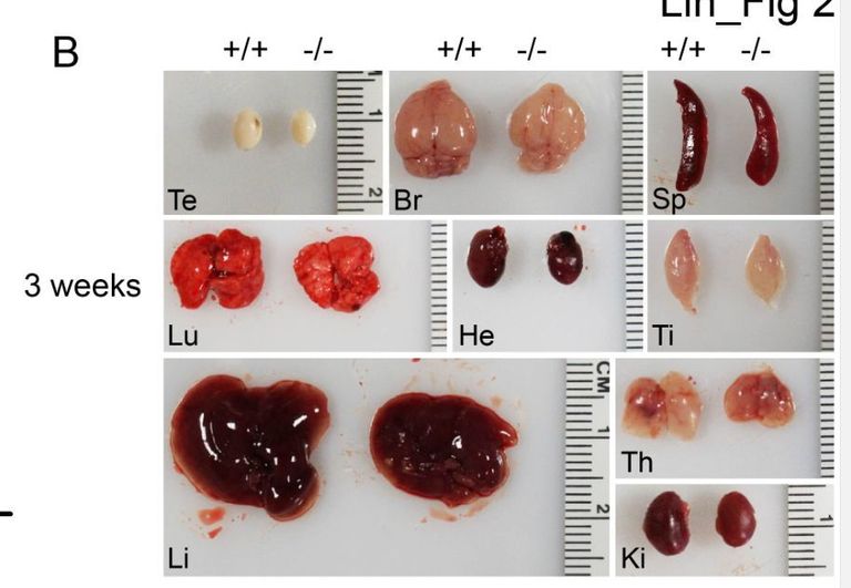 علماء صينيون يكتشفون آلية تمهد لعلاج الأورام البشرية - صورة أرشيفية