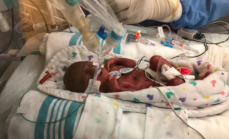 الطفلة ريما عبدالله الكعبي