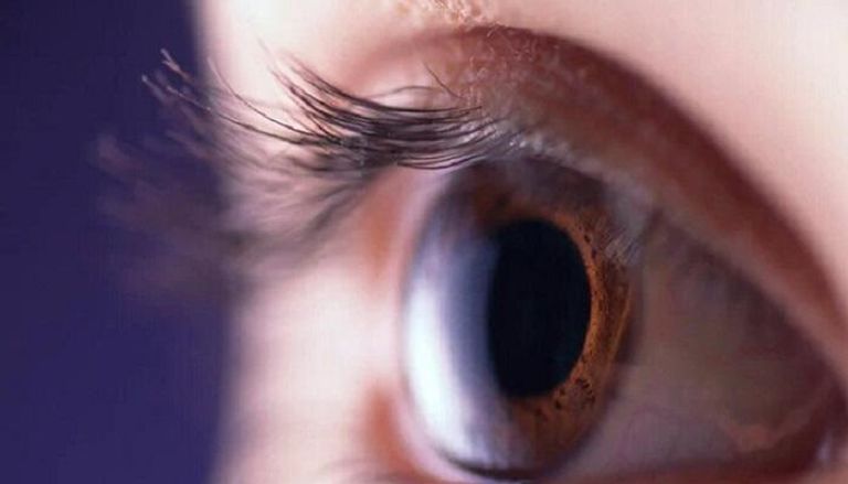 العلاقة بين الصداع النصفي وجفاف العين تتعزز مع تقدم العمر - أرشيفية