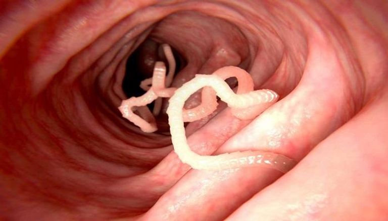 الدودة الشريطية داخل الأمعاء