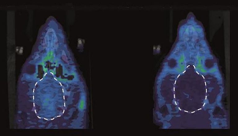 أشعة توضح مستقبلات كابا في الحالة النشطة (يمين) والحالة الخاملة (يسار)
