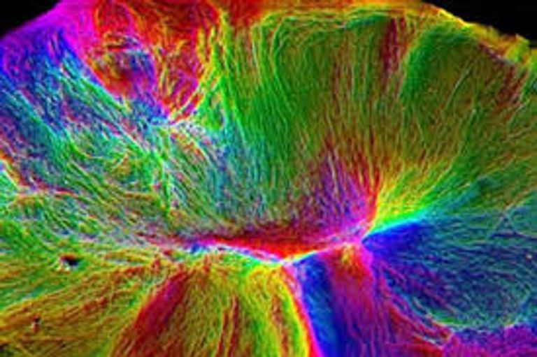 صورة "الدماغ العضوي" بالأشعة