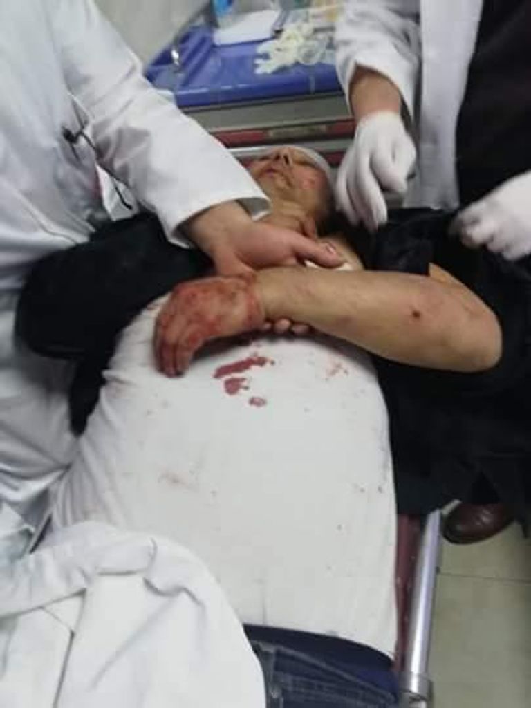 الناطق باسم حركة فتح الدكتور عاطف أبو سيف أثناء تلقى العلاج