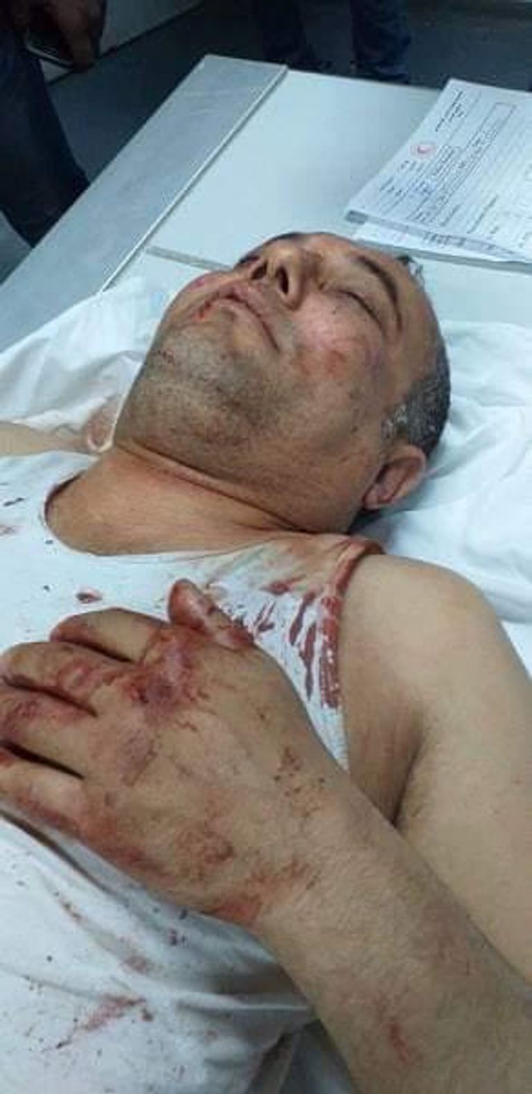 أثار الاعتداء على الدكتور عاطف أبو سيف  مسلحو حماس في غزة.. إرهاب مستمر