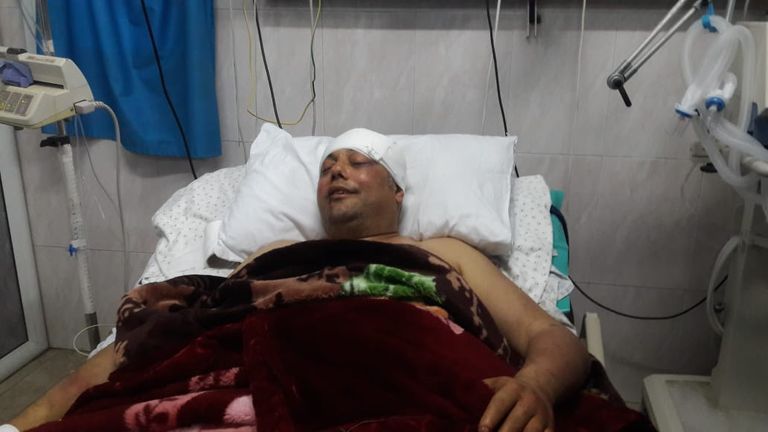 عاطف أبوسيف لـ"العين الإخبارية": كسر عظامي لن يثنيني عن مشواري الوطني