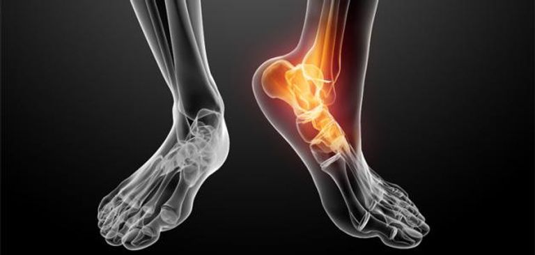 تغيّرات فسيولوجية تصيب المرأة في السنّ الـ40