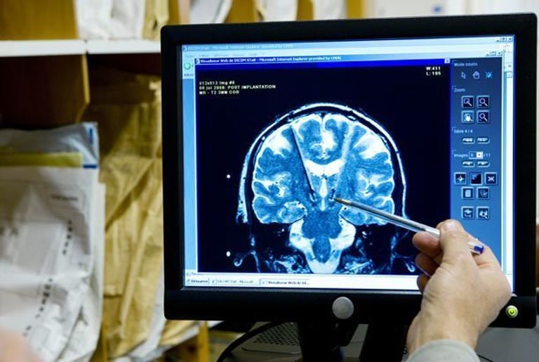 زراعة العقل الاصطناعي تمهد لإلغاء التعليم التقليدي