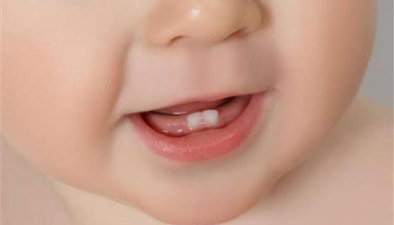 العناية بأسنان الطفل تبدأ قبل مرحلة النمو