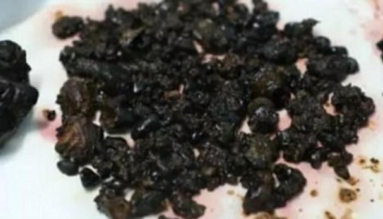 الريجيم الكيميائي