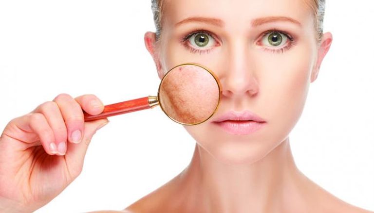 الريجيم الكيميائي