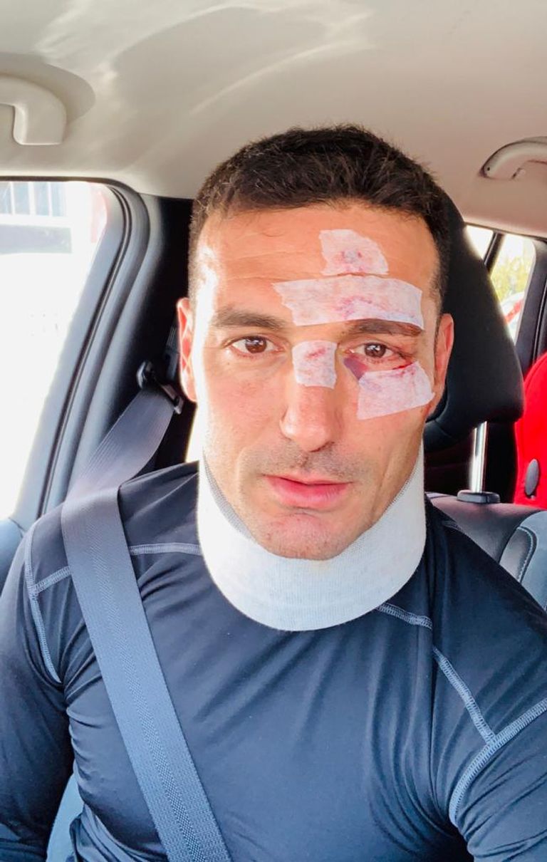 ليونيل سكالوني