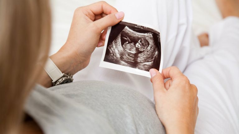 وضع النوم أثناء الحمل له تأثير  على صحة الجنين - صورة أرشيفية