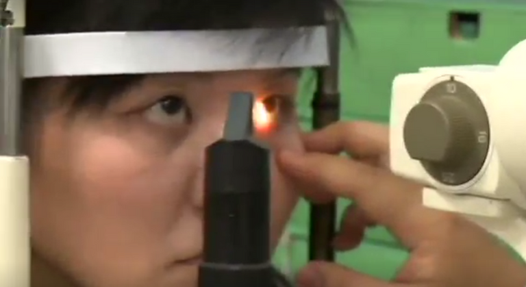 استخراج 4 نحلات من عين امرأة