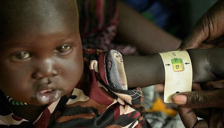  الأمراض تقتل في جنوب السودان كالحرب