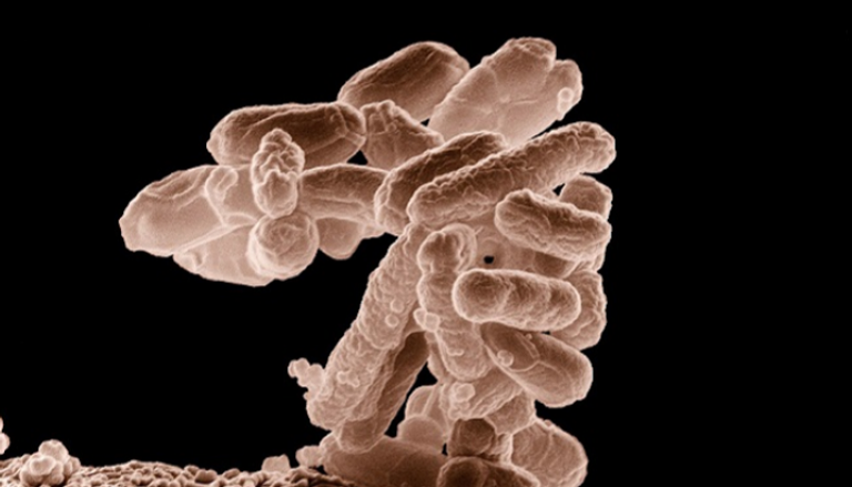 اكتشاف كيفية خداع بكتيريا مسببة للالتهابات جهاز المناعة
