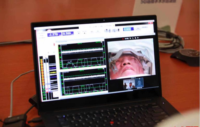 أول مسح بالموجات فوق الصوتية عن بعد