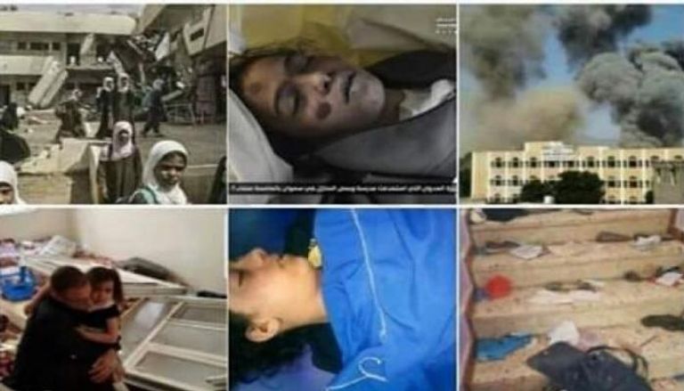 مشاهد من مجزرة سعوان الحوثية نشرتها مواقع يمنية
