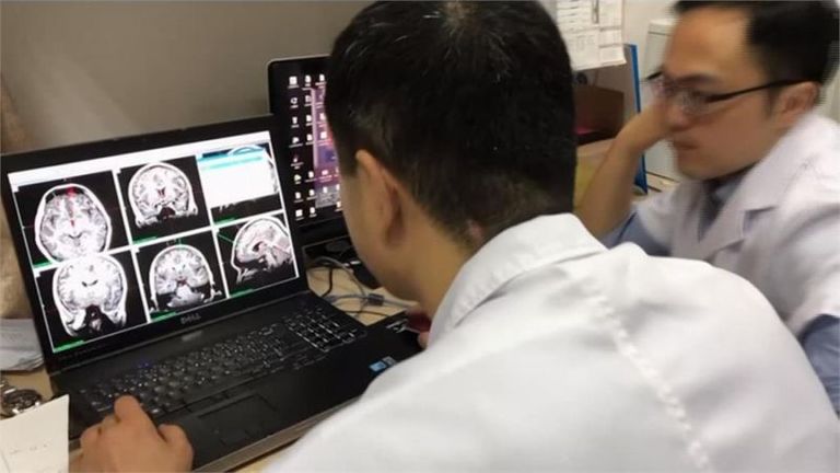  تقنية تحفيز الدماغ العميق "DBS"