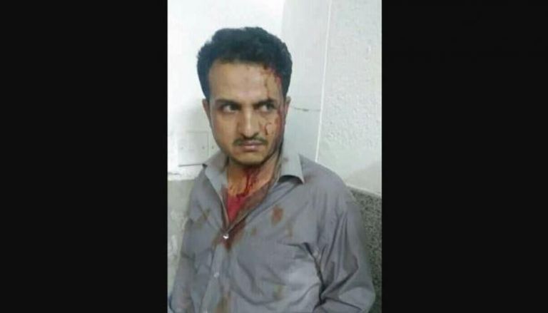الإرهاب الحوثي يهاجم الأطباء اليمنيين بلا رحمة