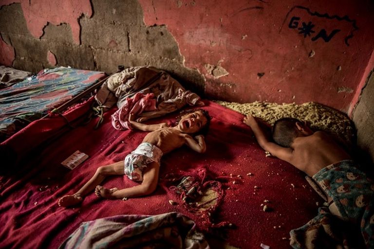 تردي الأوضاع الاقتصادية في فنزويلا يعصف بالأطفال