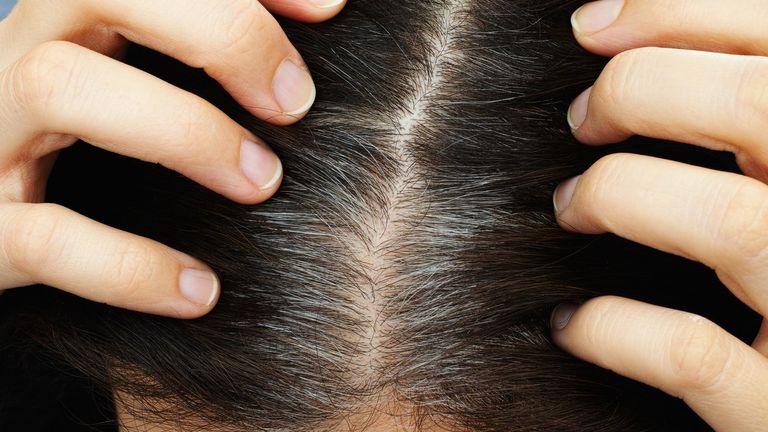 ارتداء القبعات يساهم في الحفاط على صحة الشعر