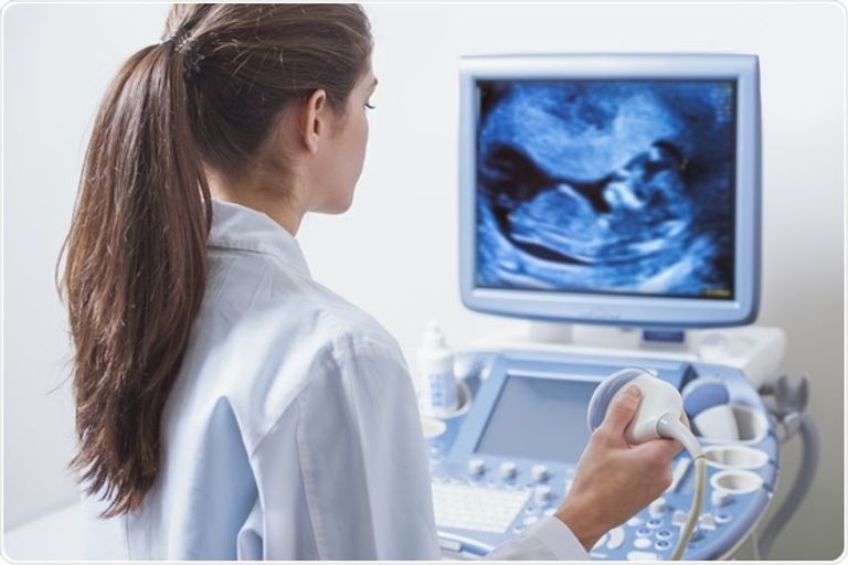 علاج جديد لمتلازمة داون قريبا