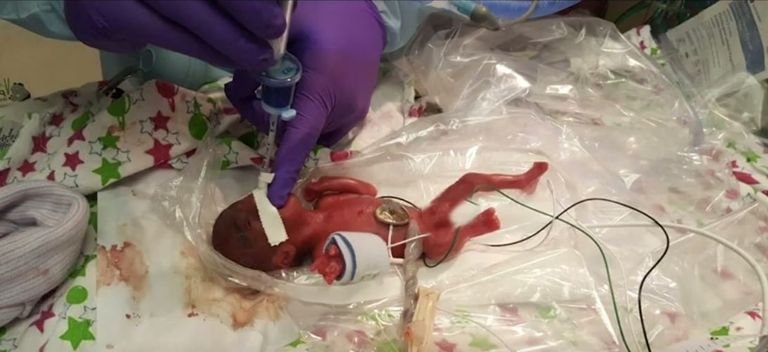 الطفلة سايبي