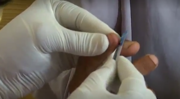 التحاليل أثبتت إصابة 681 شخصاً بالفيروس في راتوديرو منذ 25 أبريل