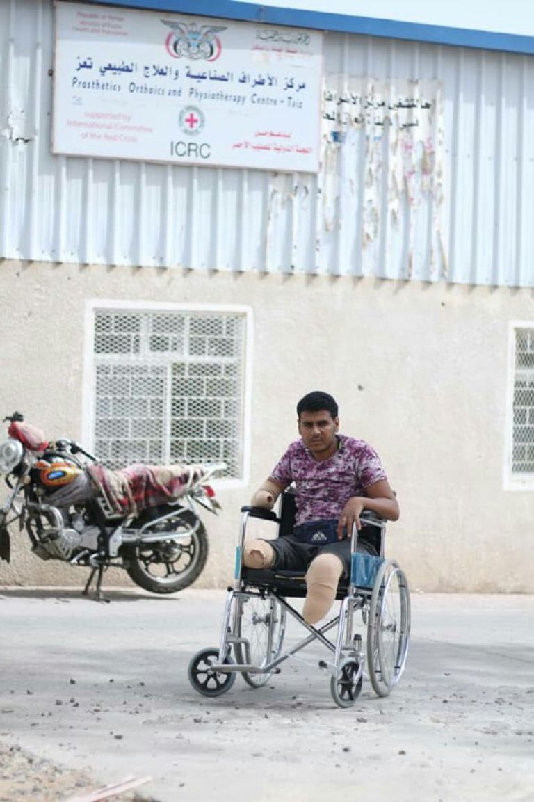 أحد الأطفال مبتورو الأطراف إثر الألغام الحوثية في تعز