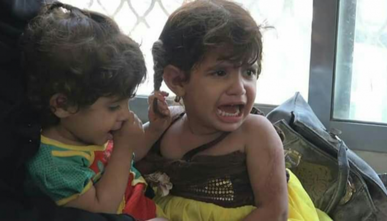 أطفال مصابون بالقصف الحوثي على حي الجشاش بتعز