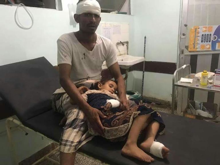 الحوثيون يغتالون براءة أطفال اليمن