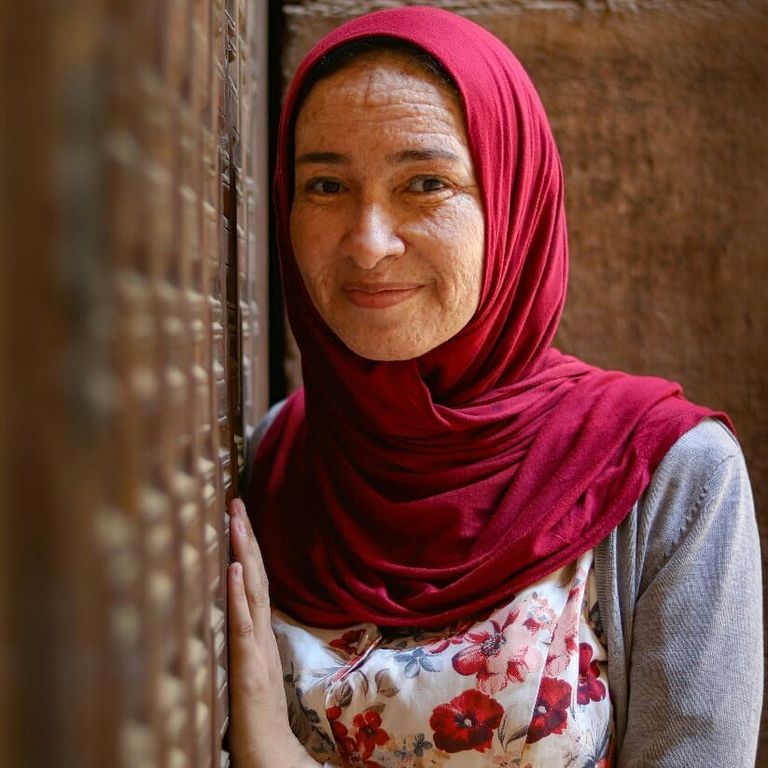 منار سعيد.. مصابة بمرض نادر في الجلد