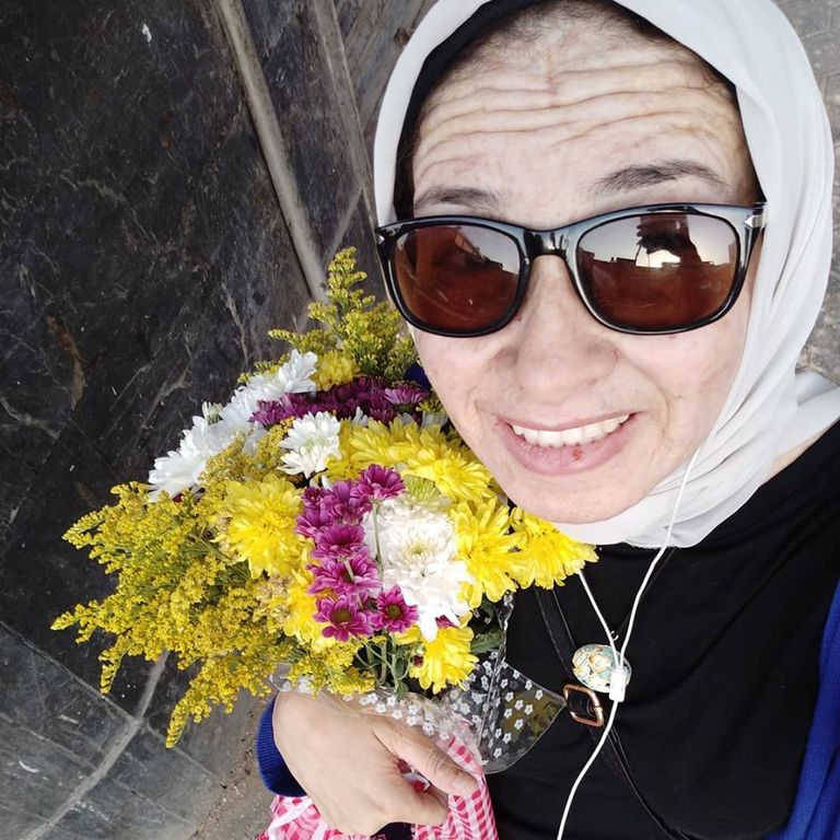 منار سعيد.. مصابة بمرض نادر في الجلد