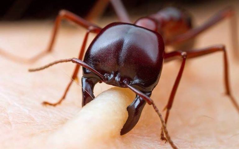 لدغ الحشرات يسبب الحكة والحساسية