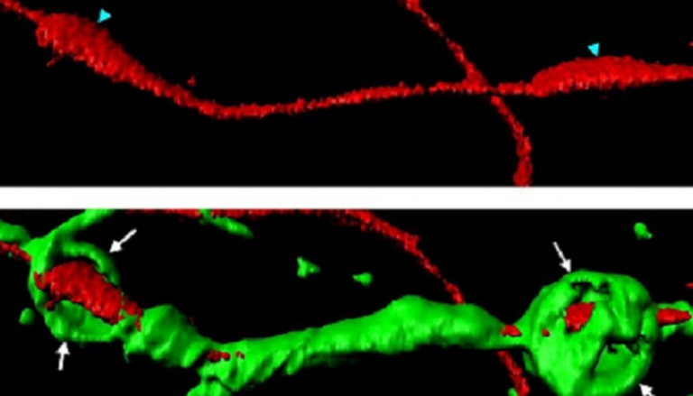 كرات أكتين (خضراء) ملفوفة حول محور عصبي مقطوع (أحمر) 
